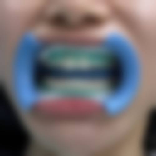 【佛山市第一人民医院口腔医学中 心参考价格表:】