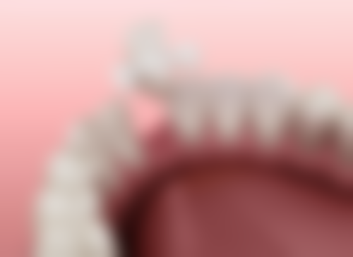 儿童补牙材料哪种好