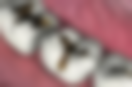 网上卖的减肥产品真的有用吗