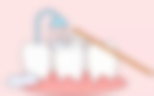 3. 五周岁地包天牙齿矫正