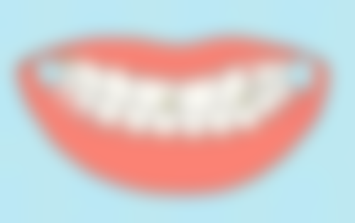 种植牙种植体脱落了怎么办