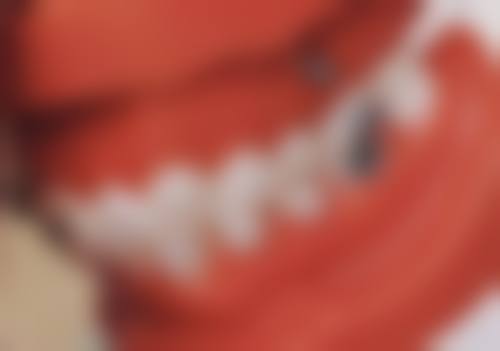 口腔初诊是不是都不会拔牙、补牙的？