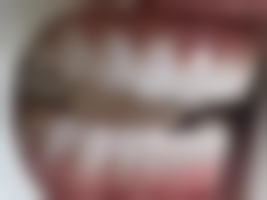 口腔初诊是不是都不会拔牙补牙的