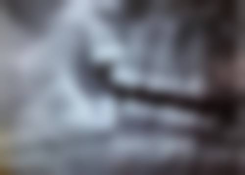 美白牙齿贴片多少钱