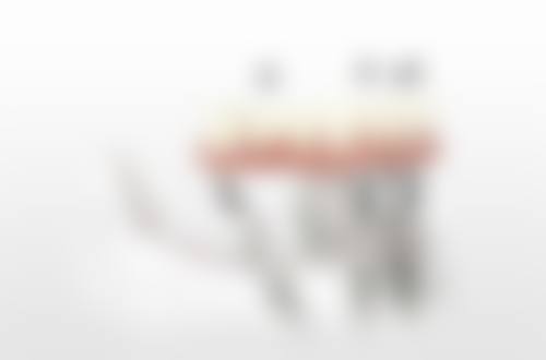 北京京大博爱口腔韩国SG种植牙项目的口碑