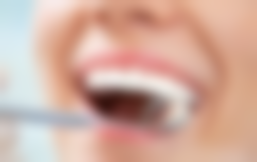 种植牙种植体植入后注意事项