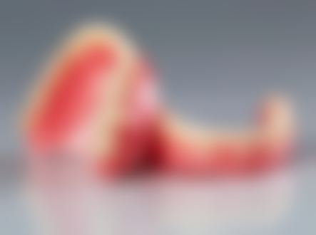 种植牙种植体是什么材质做的