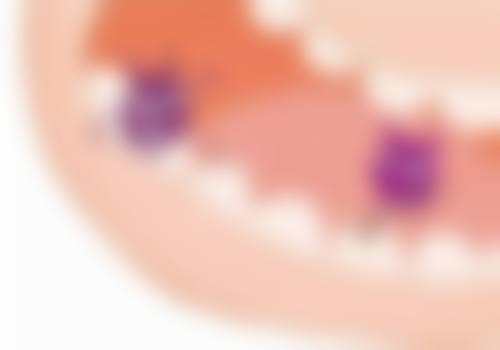 植牙患者时需要具备足够的专精知识和技能。当前多数护理人员尚未完全掌握关于种植牙的细节知识