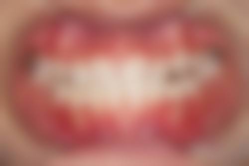 【尹万洋医生口碑怎么样？】