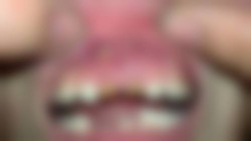 【西安曲江段银钟口腔门诊部特色项目：】