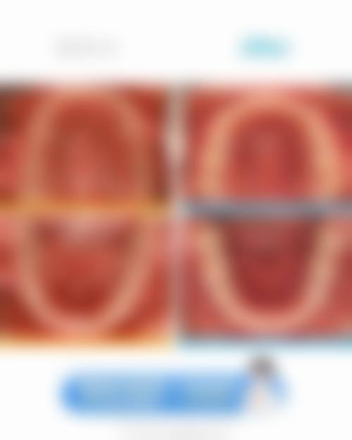 【广东深圳璨然口腔诊所特色项目：】