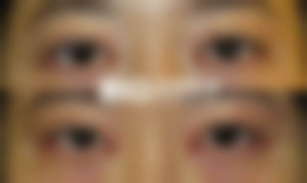 【韩国BIO整形外科特色项目：】