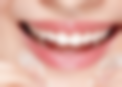 瑞士种植牙哪个牌子好？揭秘4大主流品牌优势，助你选到最适合自己的种植牙！ 