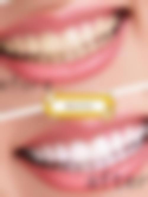 【玉溪原艳口腔诊所核心优势：】