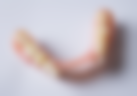 牙根处鼓了个包按压疼痛怎么办