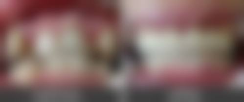 【杭州艾牙口腔诊所参考价格表：】