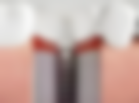 种植牙的其他相关问题