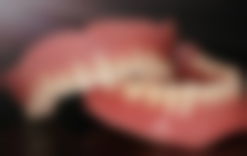 种植牙打桩后装牙冠疼吗？权威揭秘：90%的人装牙冠时疼痛轻微，轻松搞定种植牙后续流程！ 