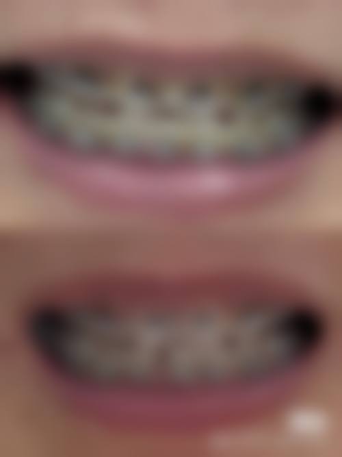 【鹏爱口腔齿科地址：】