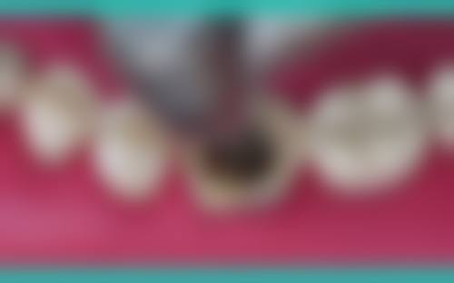 【赵洪岩医生擅长项目】