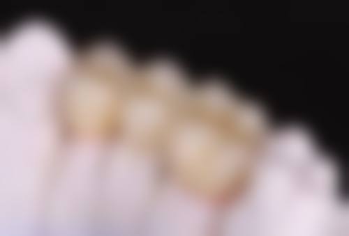 恒牙期（12岁后）治疗方案