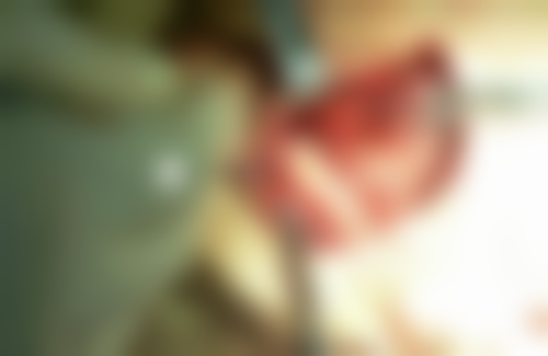 【蔡青医生口碑怎么样？】