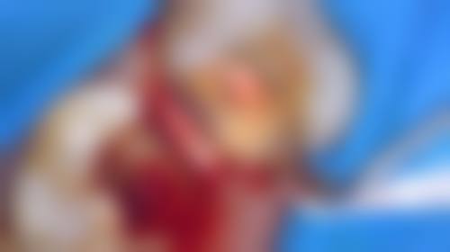 【任春霞医生口碑】