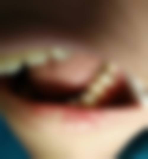 【林闽医生擅长项目:】