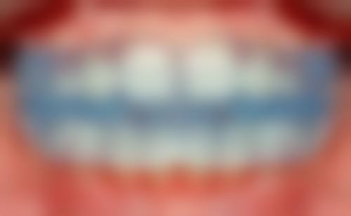 北京中诺口腔医院和北京市更出名的口腔医院相比怎么样?