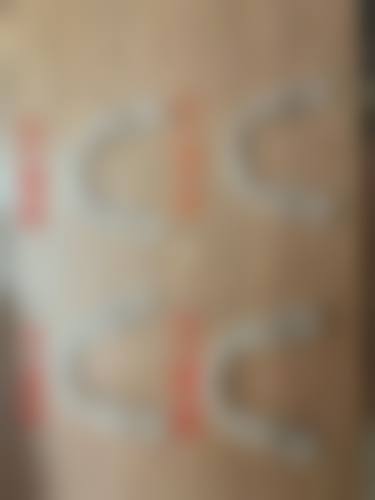 牙齿黄怎样才能变白，更简单方法