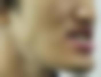 【姜欢医生擅长项目:】