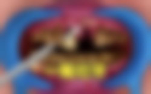 【姚望医生怎么预约挂号?】