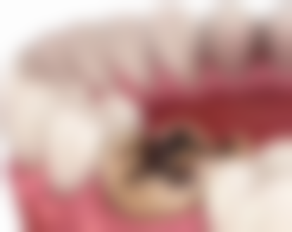 小孩地包天矫正器要带全天吗？矫正专家揭秘佩戴时长真相，助孩子告别地包天，绽放自信笑容！ 