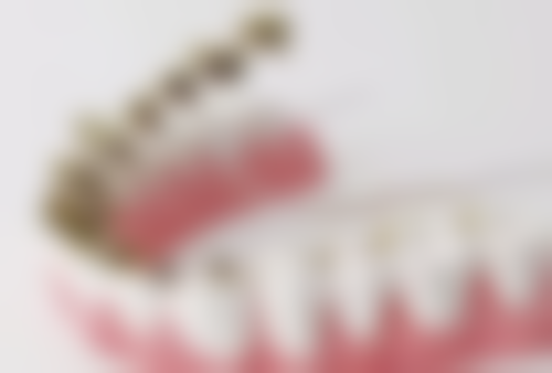 二十多岁地包天的矫正选择