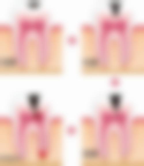 【周阳医生擅长项目】