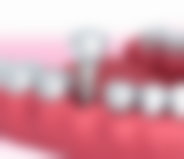 all - on - four种植牙技术