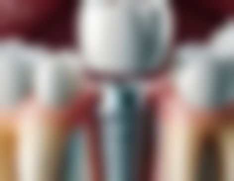 牙齿美白何其重要