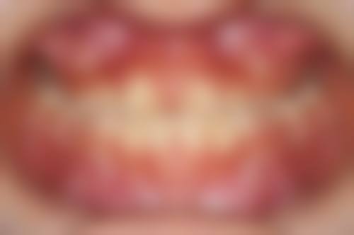 【刘莹医生擅长项目】