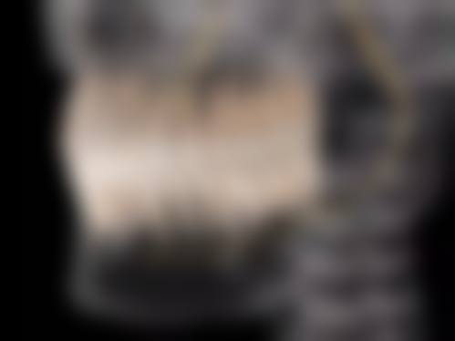 【关雨莹医生技术特点】