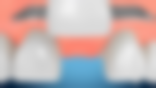 30岁做牙齿矫正的危害