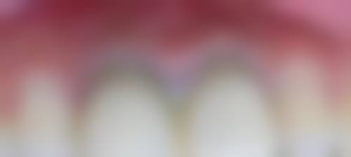 【黄体斌医生口碑怎么样？】