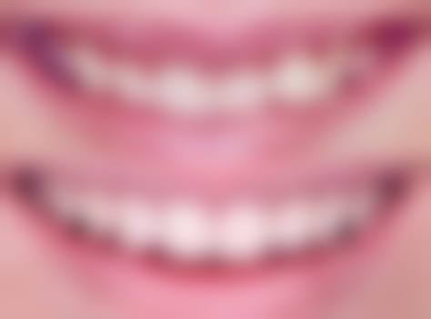 【佛山华南齿域口腔门诊部参考价格表：】