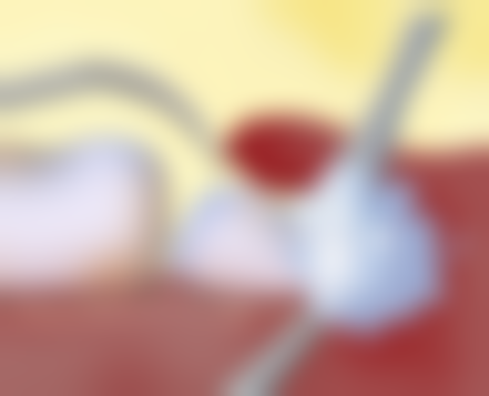 30多岁做牙齿矫正会有后遗症吗为什么