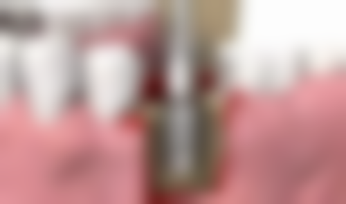 【康凯医生擅长项目】