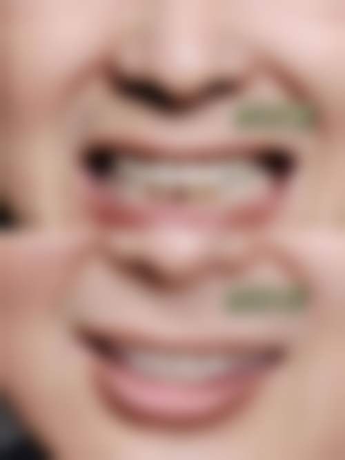 【上海交通大学医学校苏州九龙医院口腔科参考价格表：】