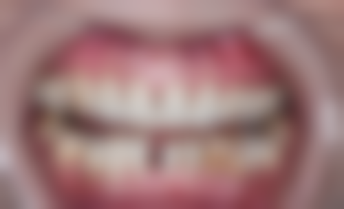 【罗金燕医生怎么预约挂号?】