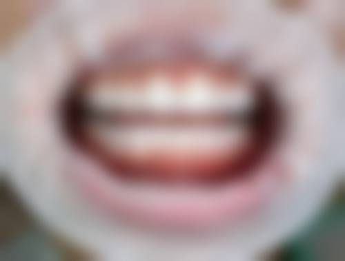 【湛江赵勤口腔诊所特色项目：】