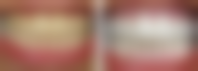 【任兴彬医生擅长项目：】