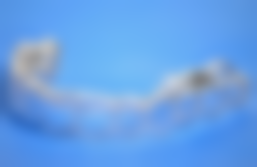 腭裂手术后会引起面部变化吗