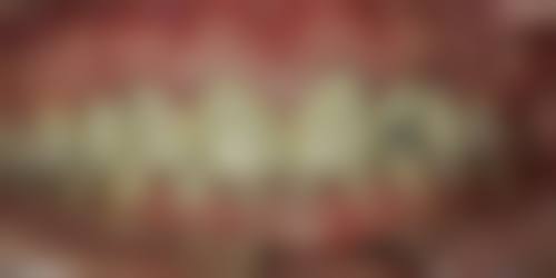 【李昌轩医生口碑怎么样？】